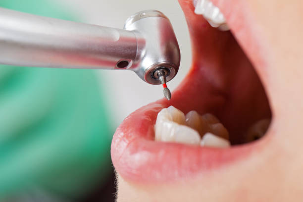 Best Cracked Tooth Emergency Dentist  in Plandome, NY